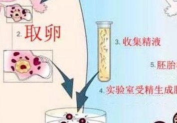 郑州有哪些医院做试管婴儿更好？