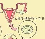 合肥双角子宫试管医院名单更新，当地三代试管医院推荐