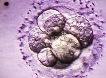 了解泰国第三代试管婴儿技术有什么弊端！